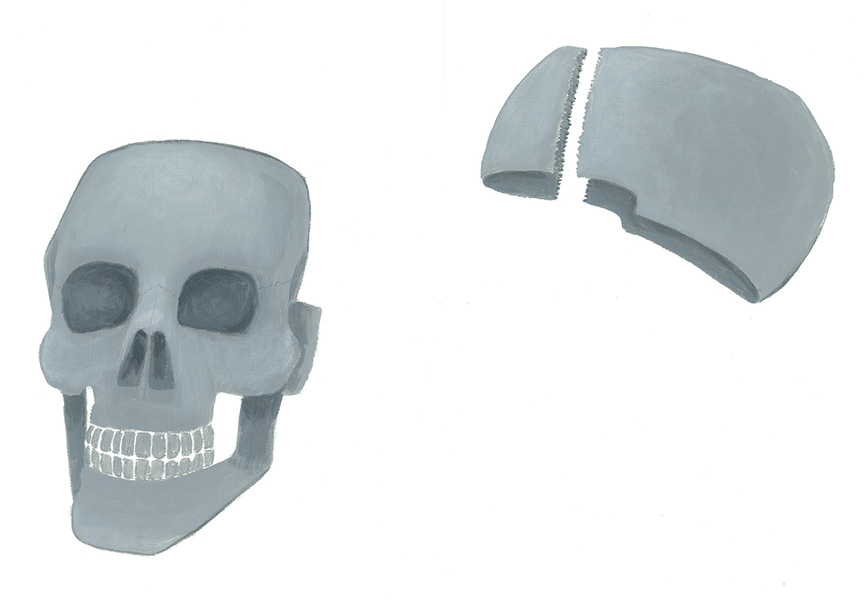  Facial bones and skull bones 
