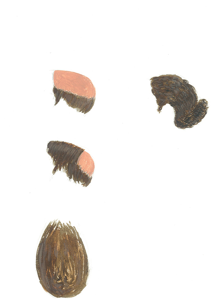  Patterns of hair and hair loss